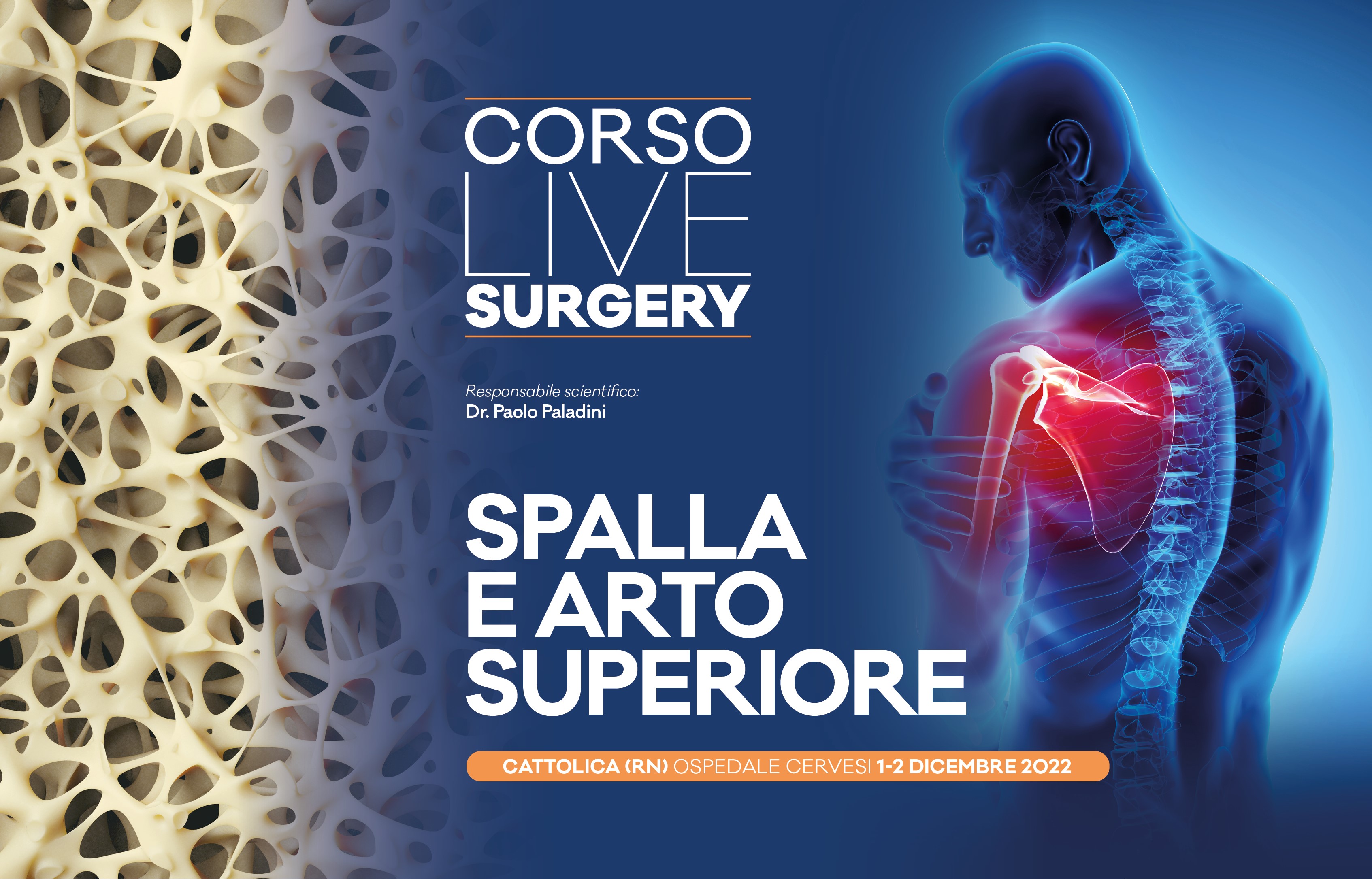 Course Image Corso Live Surgery - SPALLA E ARTO SUPERIORE
